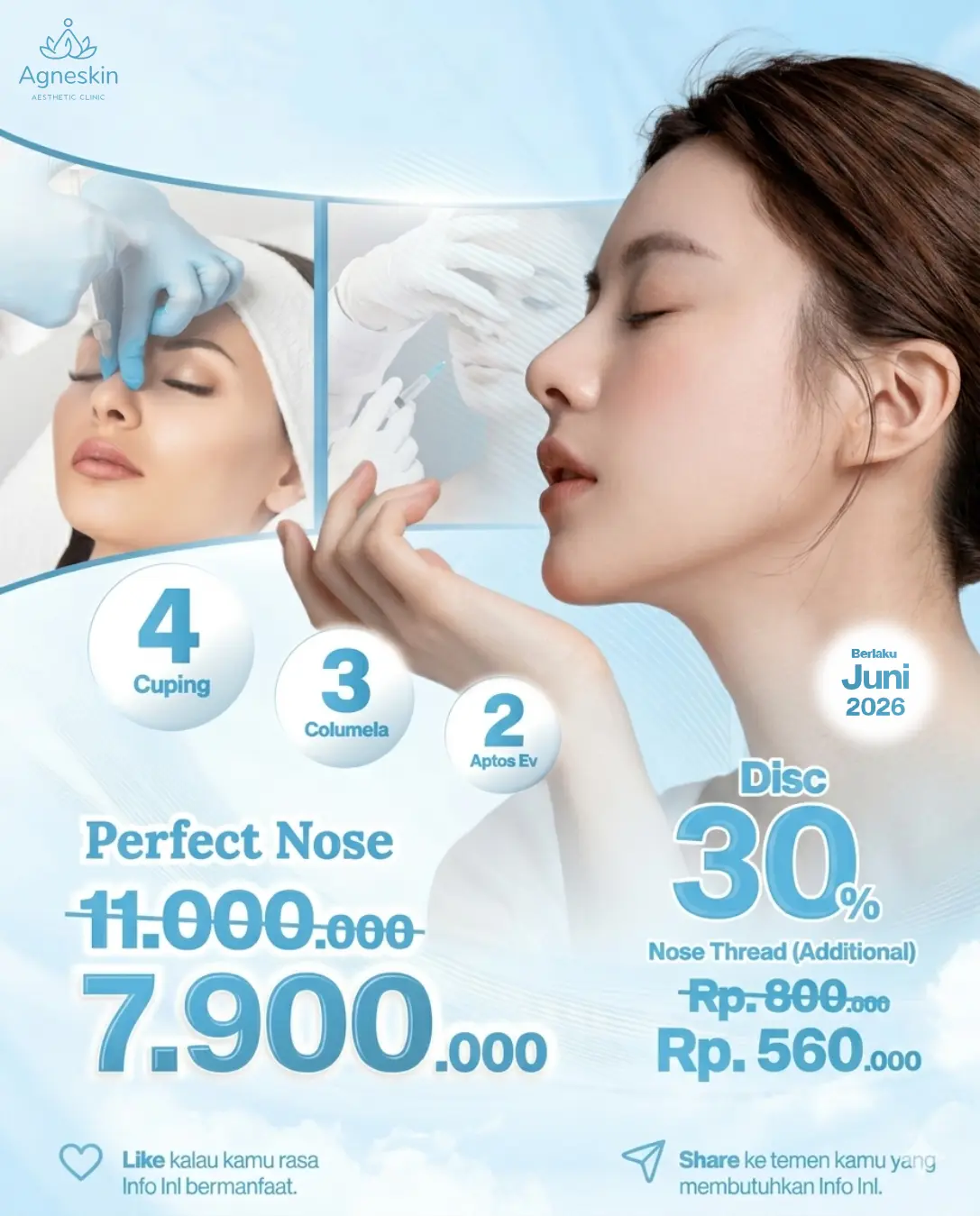Promo Perfect Nose Juni 2026